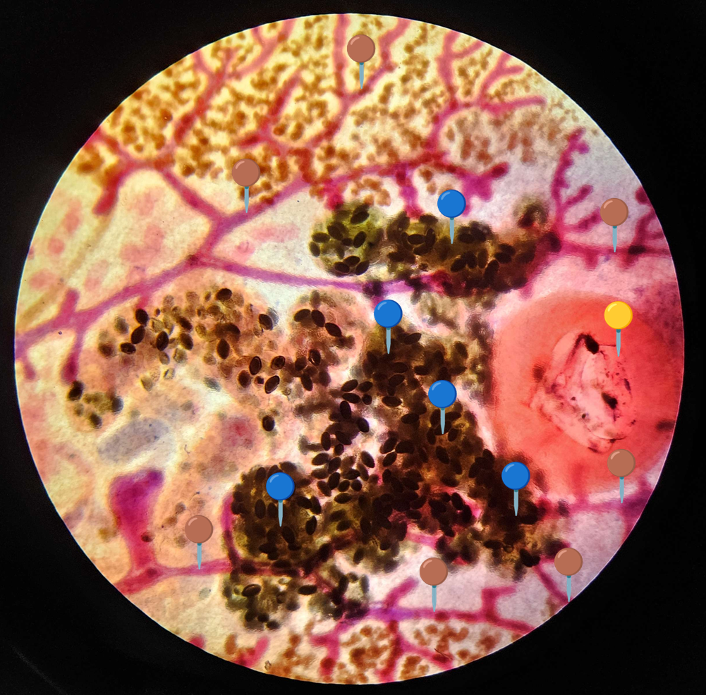 <p><strong><em>Fasciola hepatica</em></strong></p><p>(Postać dojrzała)</p><p></p><p></p><p><strong>Organelle:</strong></p><p></p><ul><li><p><span data-name="red_circle" data-type="emoji">🔴</span><span data-name="yellow_circle" data-type="emoji">🟡</span><span data-name="green_circle" data-type="emoji">🟢</span><span data-name="blue_circle" data-type="emoji">🔵</span><span data-name="purple_circle" data-type="emoji">🟣</span><span data-name="black_circle" data-type="emoji">⚫</span><span>️</span><span data-name="white_circle" data-type="emoji">⚪</span><span data-name="brown_circle" data-type="emoji">🟤</span></p></li></ul><p></p><ul><li><p><span data-name="red_circle" data-type="emoji">🔴</span><span data-name="yellow_circle" data-type="emoji">🟡</span><span data-name="green_circle" data-type="emoji">🟢</span><span data-name="blue_circle" data-type="emoji">🔵</span><span data-name="purple_circle" data-type="emoji">🟣</span><span data-name="black_circle" data-type="emoji">⚫</span><span>️</span><span data-name="white_circle" data-type="emoji">⚪</span><span data-name="brown_circle" data-type="emoji">🟤</span></p></li></ul><p></p><ul><li><p><span data-name="red_circle" data-type="emoji">🔴</span><span data-name="yellow_circle" data-type="emoji">🟡</span><span data-name="green_circle" data-type="emoji">🟢</span><span data-name="blue_circle" data-type="emoji">🔵</span><span data-name="purple_circle" data-type="emoji">🟣</span><span data-name="black_circle" data-type="emoji">⚫</span><span>️</span><span data-name="white_circle" data-type="emoji">⚪</span><span data-name="brown_circle" data-type="emoji">🟤</span></p></li></ul><p></p><p></p><p><strong>Parazytoza:</strong><em> Fascjoloza</em></p>