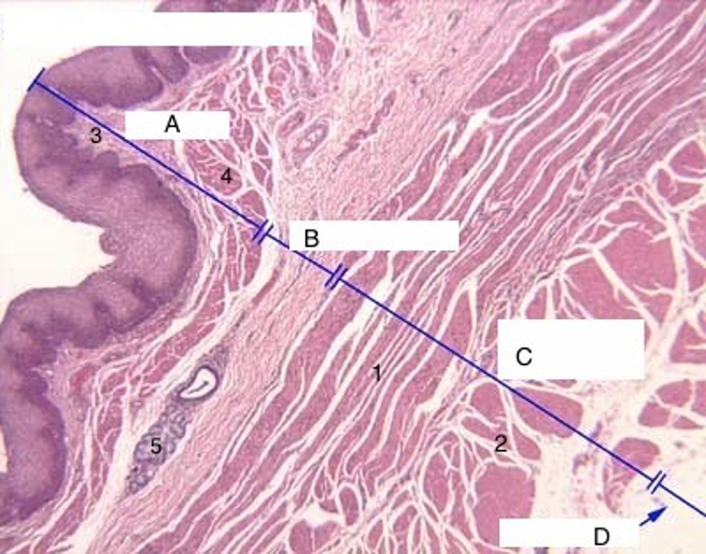 <p>(C) superior third of the esophagus is skeletal muscle, the intermediate third is skeletal and smooth muscle, the inferior third is smooth muscle.</p>