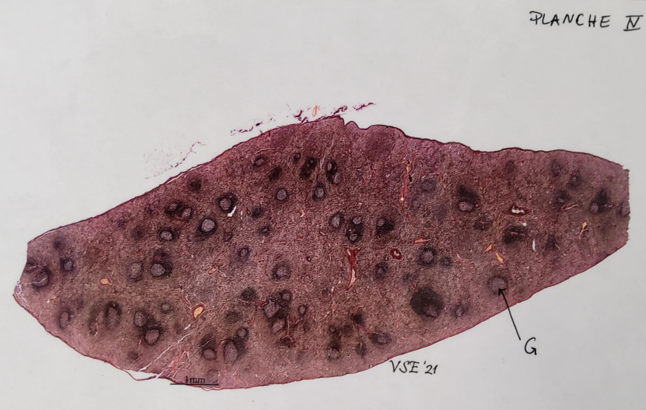 **Post 5.**

__PLANCHE IV viser et histologisk snit af en milt.__

\
**Spørgsmål 10:** Benævn strukturen G