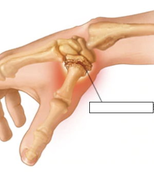 <p>what is the highlighted joint?</p>
