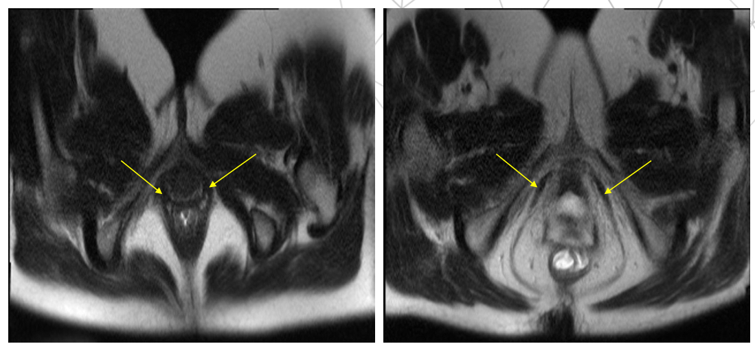 <p>Xung gì, thì gì</p>