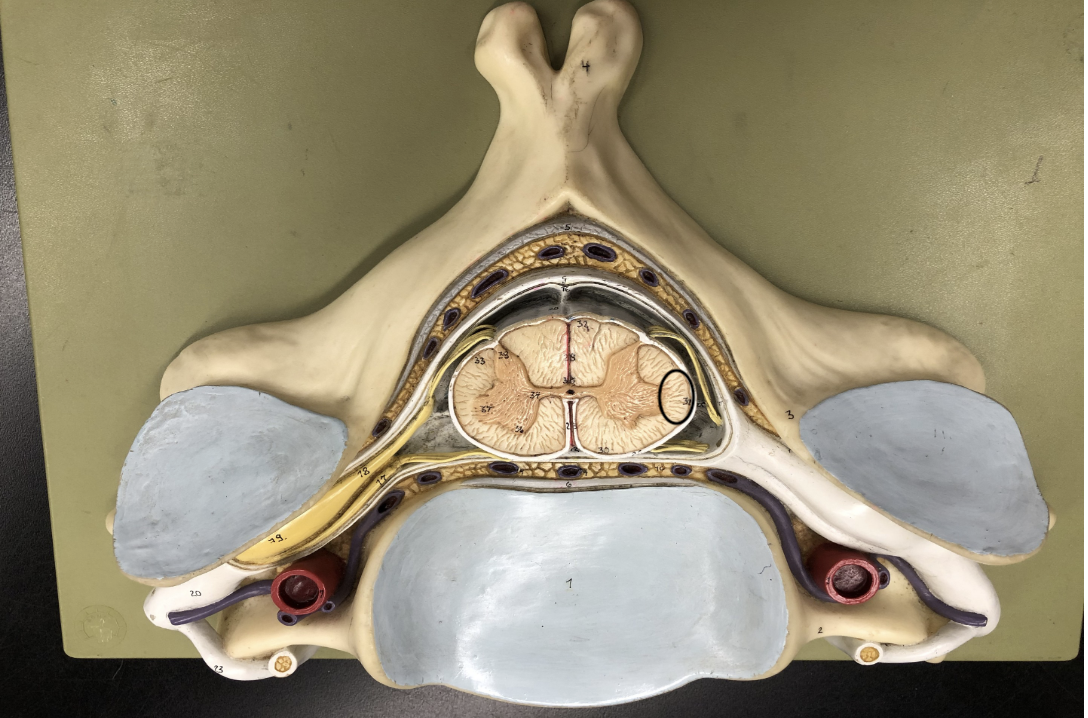 <p>what is this part of the vertebrae (of the spinal cord?)</p>