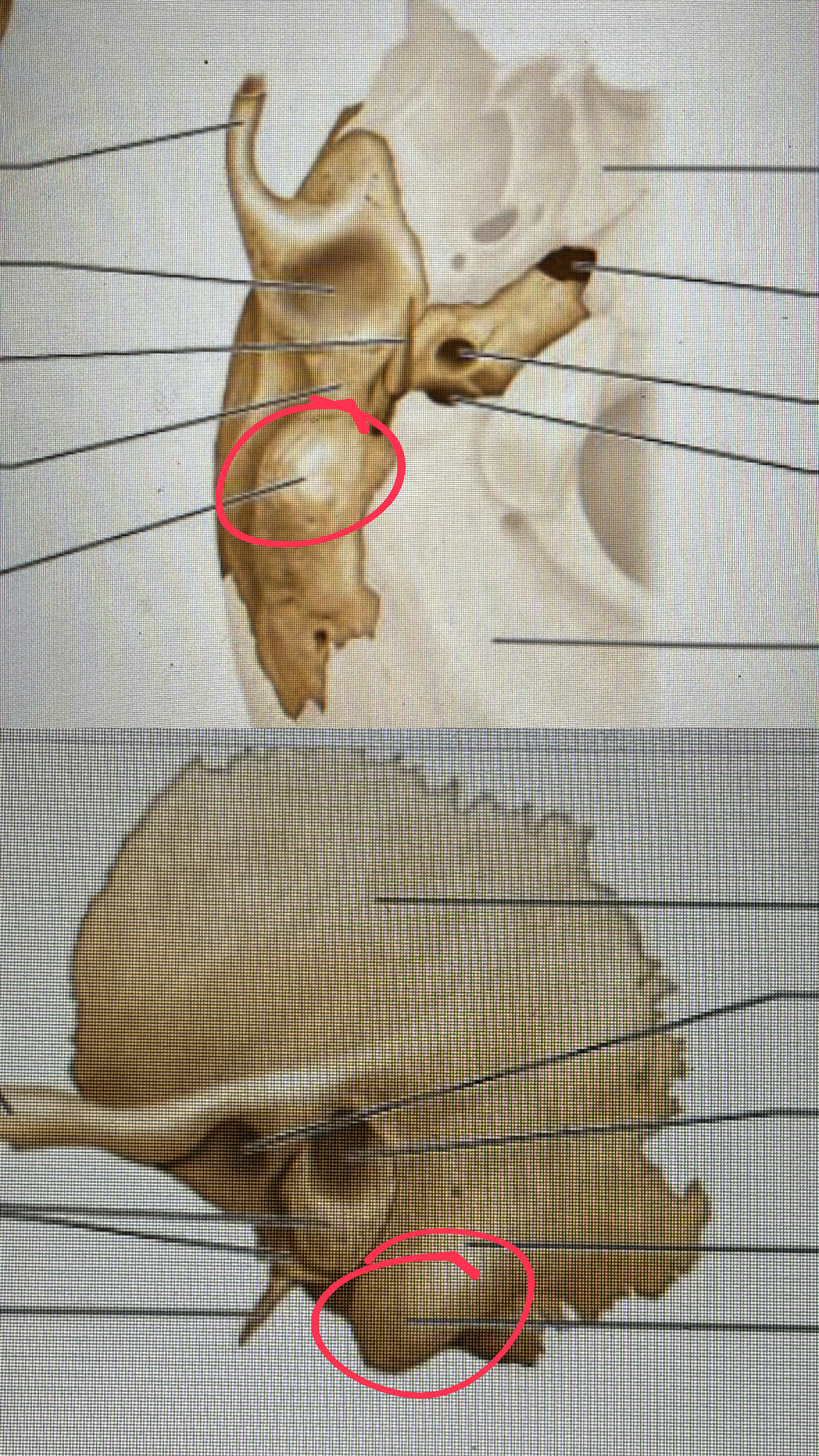 <p>round projection next to the styloid process</p>