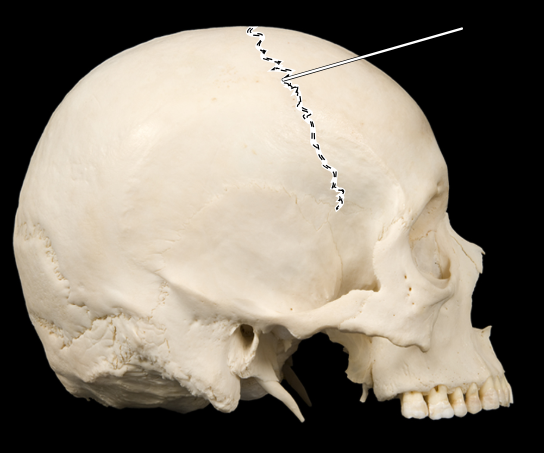 <p><span><strong>Coronal suture</strong></span></p>