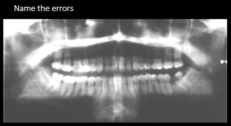 <p>Name the errors</p>