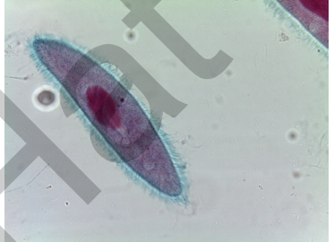 <p>what free living protozoa is this</p>