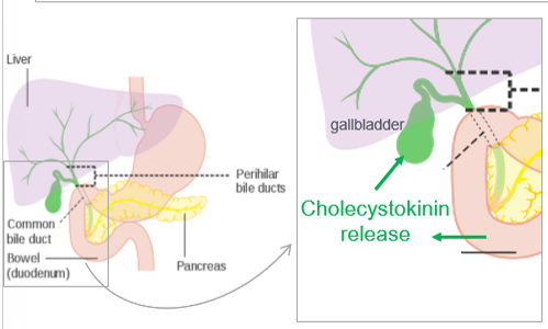 <p>broken down, large fatty deposits are emulsified by bile which is released from the gallbladder. bile is then broken down into bile salt, bilirubin, cholesterol, phospholipids, water, etc</p>