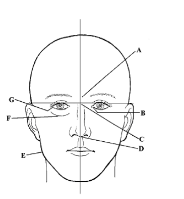 <p><strong>Identify letter E</strong><br>A. Gonion (angle of mandible)<br>B. Acanthion<br>C. Infraorbital margin<br>D. Nasion</p>