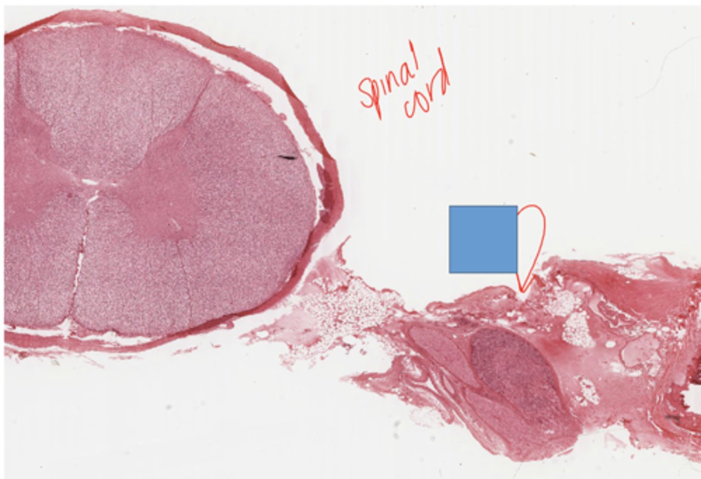<p>Identify the following structure in PNS</p>