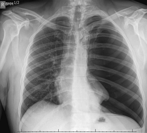 <p>What is this pathology?</p>