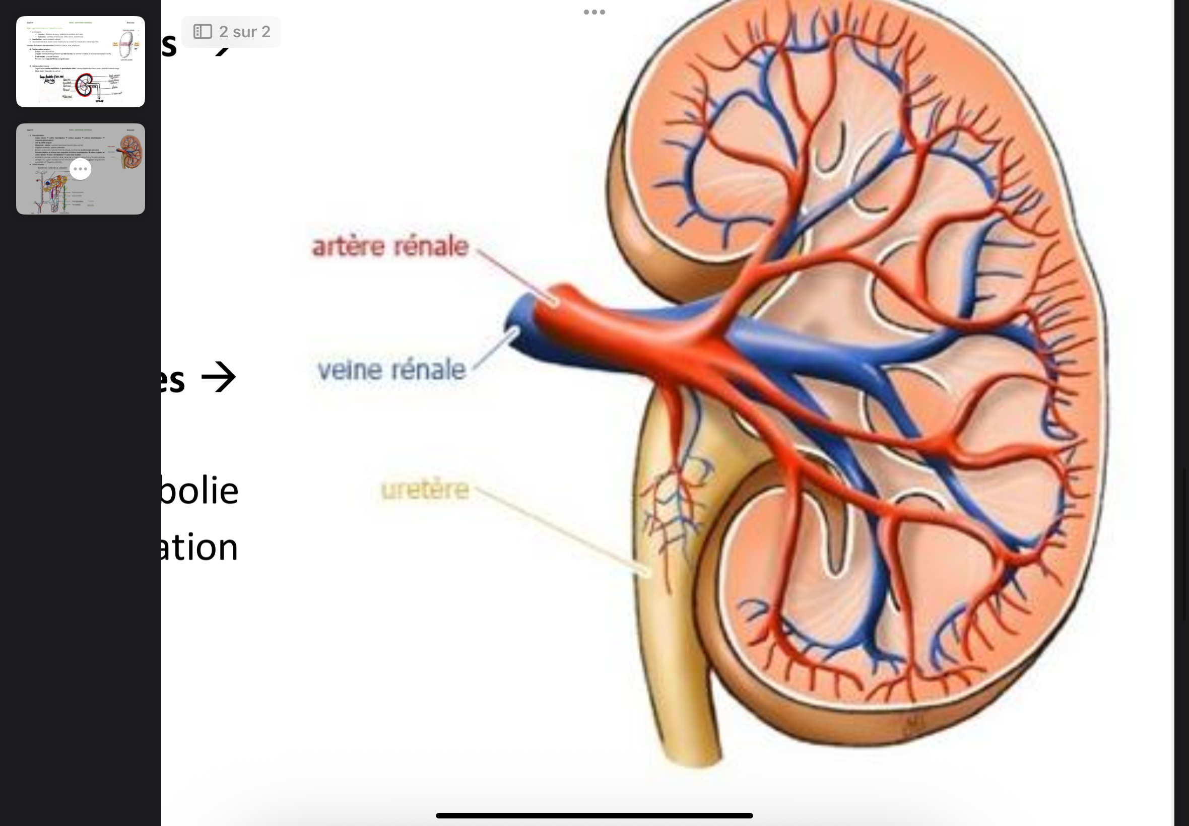 <p>3.<strong> </strong>Vascularisation</p><p>- Artère rénale → artère interlobaires → artères arquées → artères interlobulaires →</p><p>artérioles glomérulaires</p><p>- 25% du débit sanguin</p><p>- Glomérule + tubule = système fonctionnel du rein (dans cortex)</p><p>- Irrigation terminale, système admirable</p><p>- Réseau veineux sous capsulaire très développé, nombreuses anastomoses veineuses.</p><p>- Veinules étoilées et réseau sous-scapulaire → veines interlobulaires → veines arquées →</p><p>veines droites → veines interlobaires → veine cave caudale</p><p>- Application clinique = infarctus rénal, causé par occlusion / obstruction / thrombo embolie</p><p>aortique, etc., a pour conséquence une nécrose tissulaire de forme triangulaire (organisation</p><p>pyramidale de l’irrigation artérielle).</p>