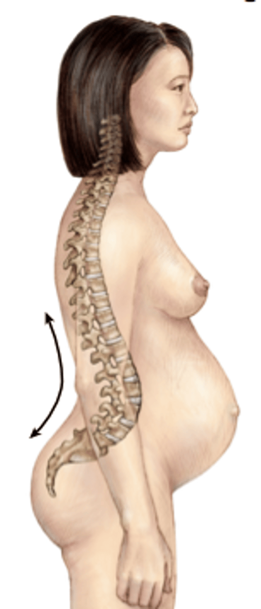 <p>bent forward, increased concavity of the spine</p>