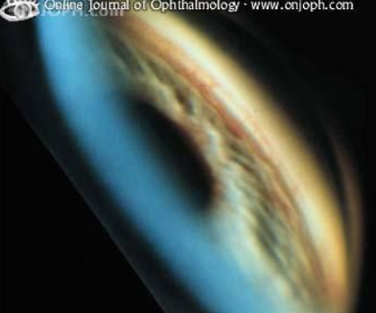 <p>what is the most posterior structure in this image</p>
