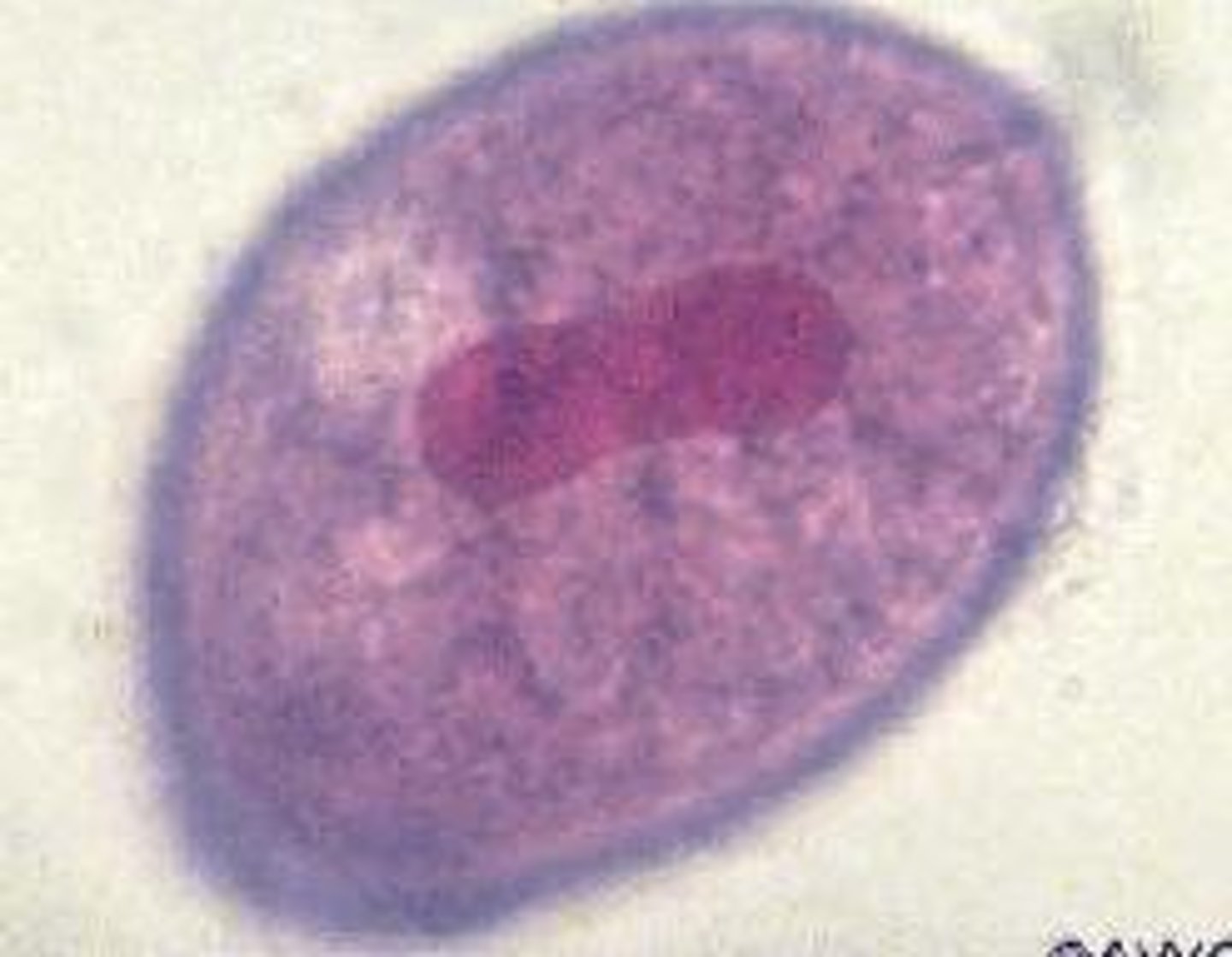 <p>The only human parasite among ciliates, causing dysentery</p>