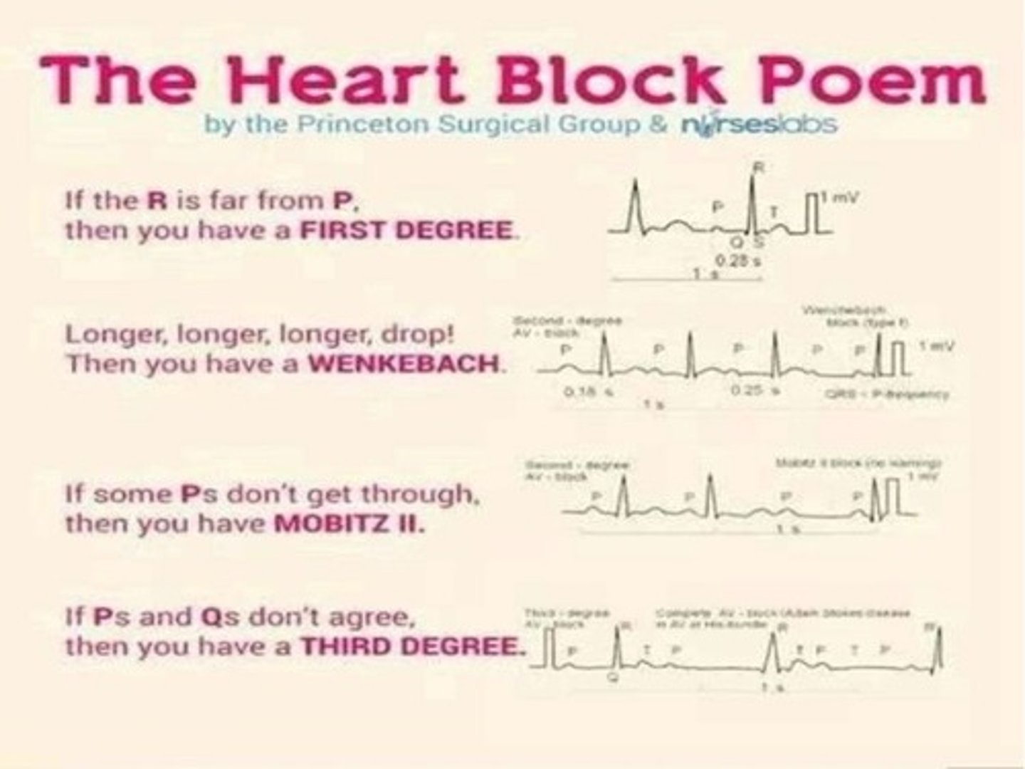 <p>An AV block exists when conduction through the AV node or bundle of His is delayed or blocked.</p><p>AV blocks increase in seriousness from first-degree, to second-degree type I, to second-degree type II, to third-degree (complete) block.</p><p>third-degree heart block as the most serious because perfusion is poor when atria and ventricles beat independently.</p><p>Inferior MI may be associated with AV nodal ischemia and AV blocks because of right coronary artery involvement.</p><p>Type I and some bradyarrhythmias may be medication-related, especially from beta blockers, digoxin, or calcium channel blockers.</p>