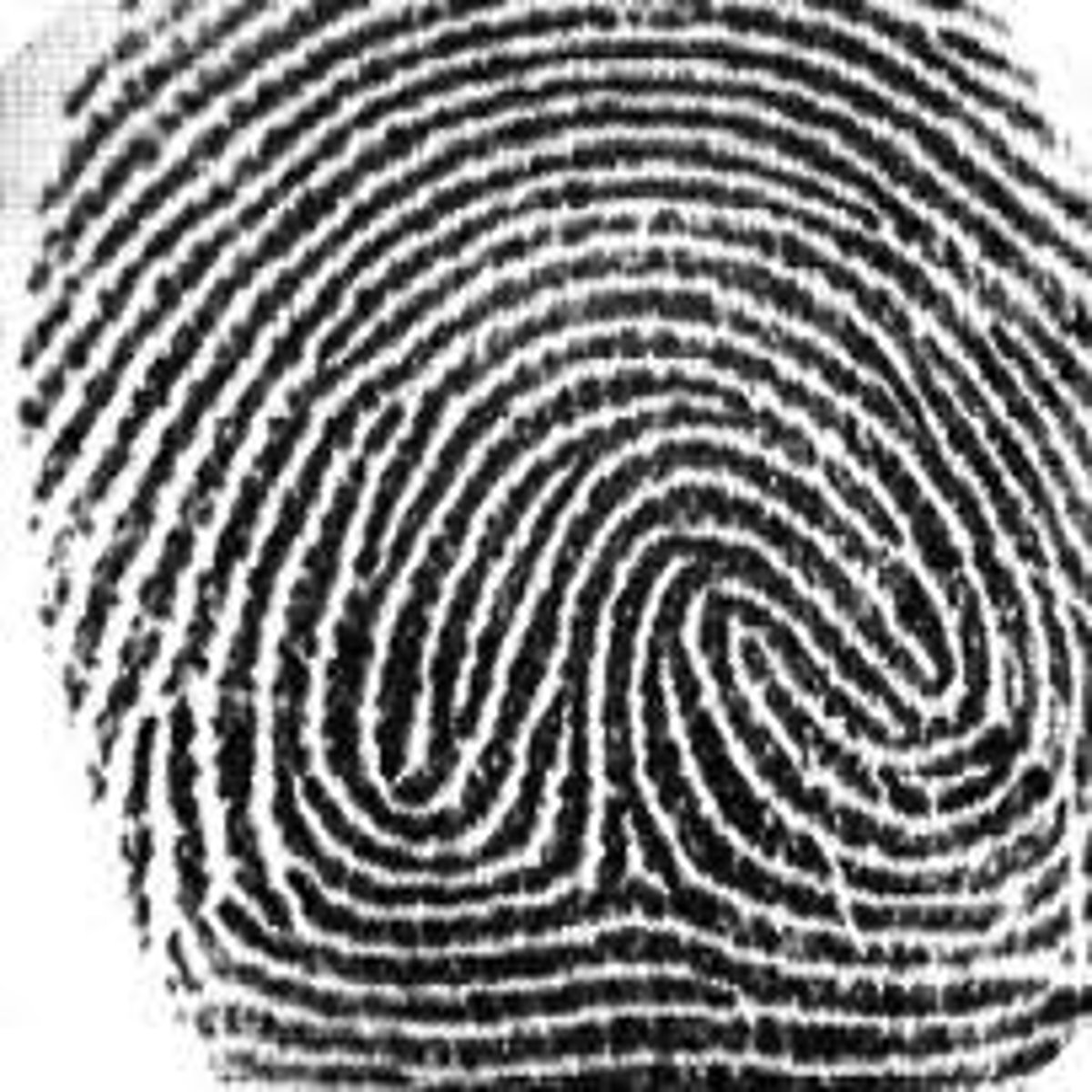 <p>Multiple whorl types within one pattern that does not fit into one of the sub-pattern types above</p>