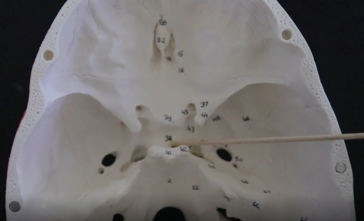 <p>depression in the sphenoid bone that protects and houses the pituitary gland</p>