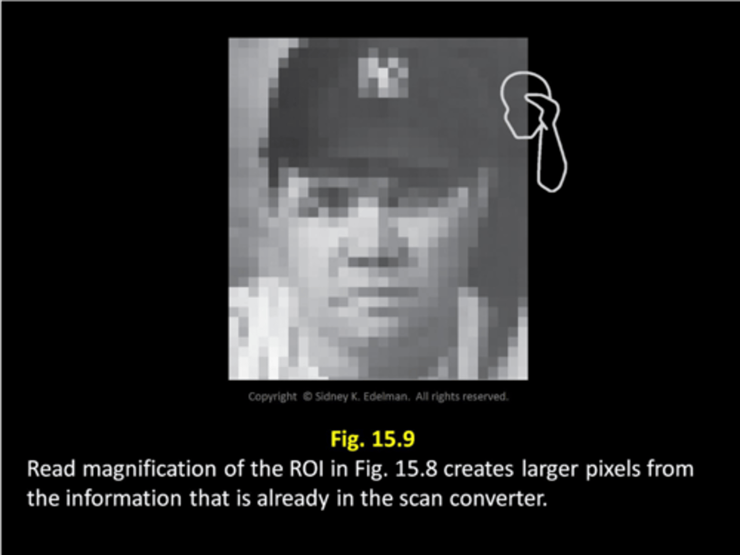 <p>1. system scans anatomy</p><p>2. image is converted from analog to digital and stored</p><p>3. ROI is identified and system reads and displays original data, ROI is NOT rescanned</p>