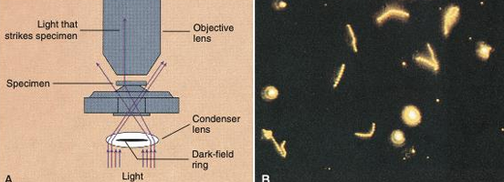 <p>Microscope?<br>Detects what?<br>Organism example?</p>