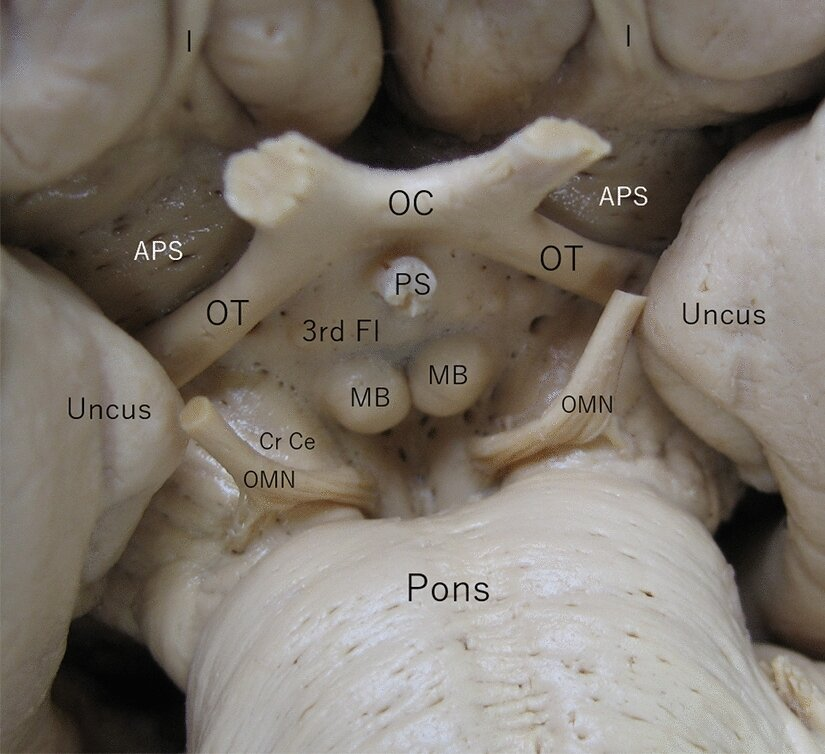 <p>posterior to optic chiasm </p>