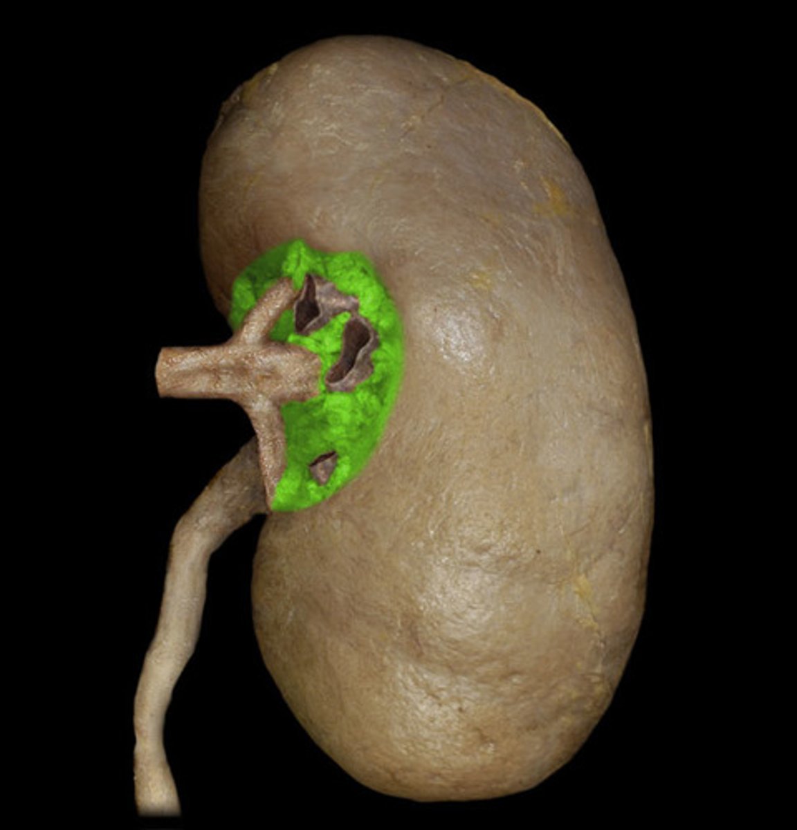 <p>Notch, or indentation, in center of medial surface of kidney.</p><p>Location of entrance/exit of renal vessels, nerves (consist of sympathetic fibers that regulate vascular smooth muscle of kidneys and renin secretion), and ureter.</p>