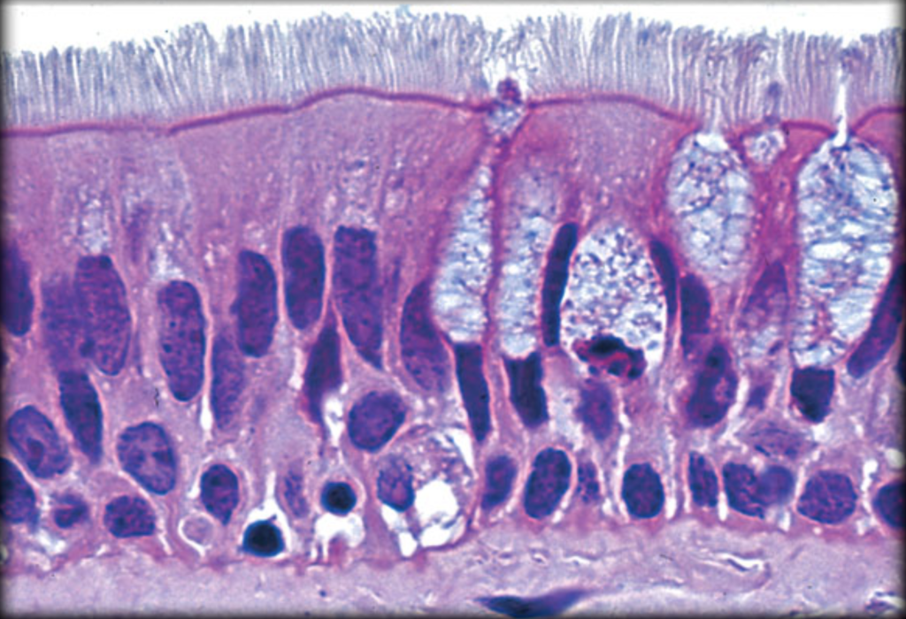 <p>What type of epithelium is indicated by the green arrow?</p>