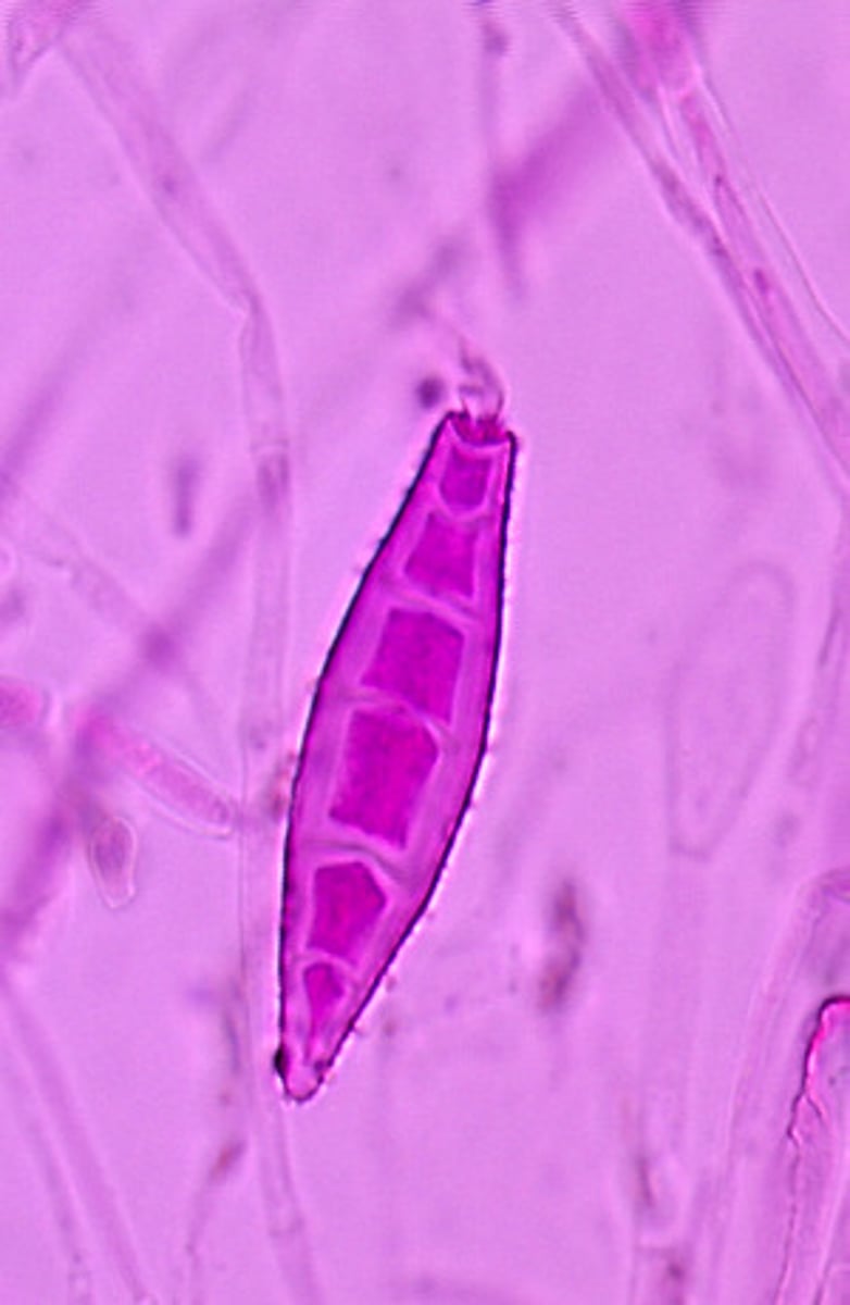 <p>Microsporum canis produces rough, spindle-shaped, thick-walled macroconidia.</p>