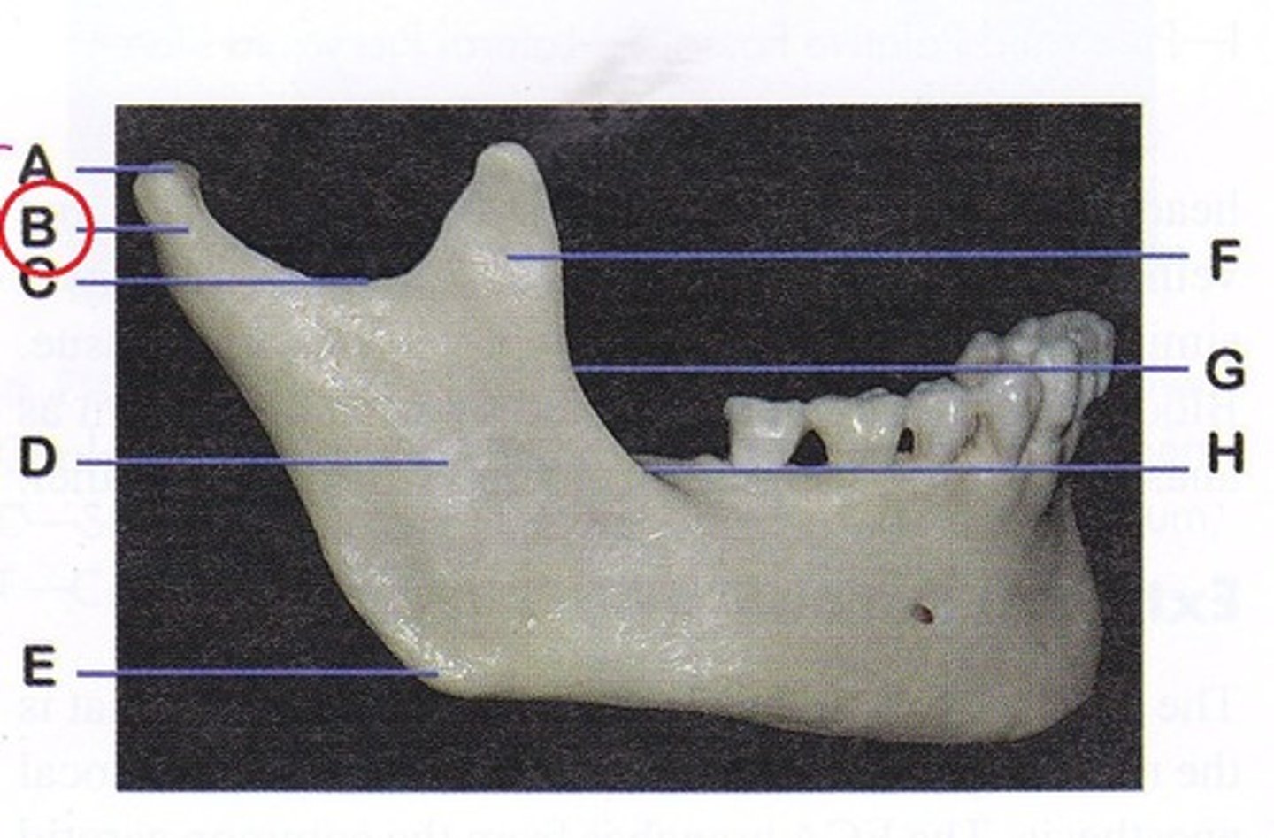 <p>slightly narrowed area just beneath the condyle</p>