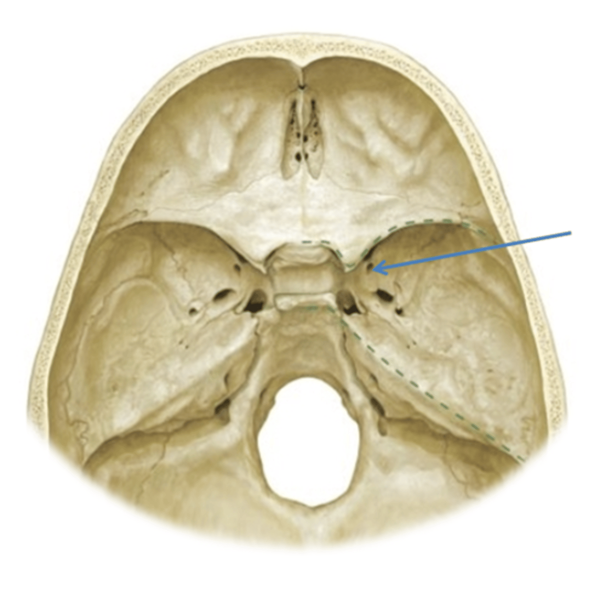 knowt flashcard image