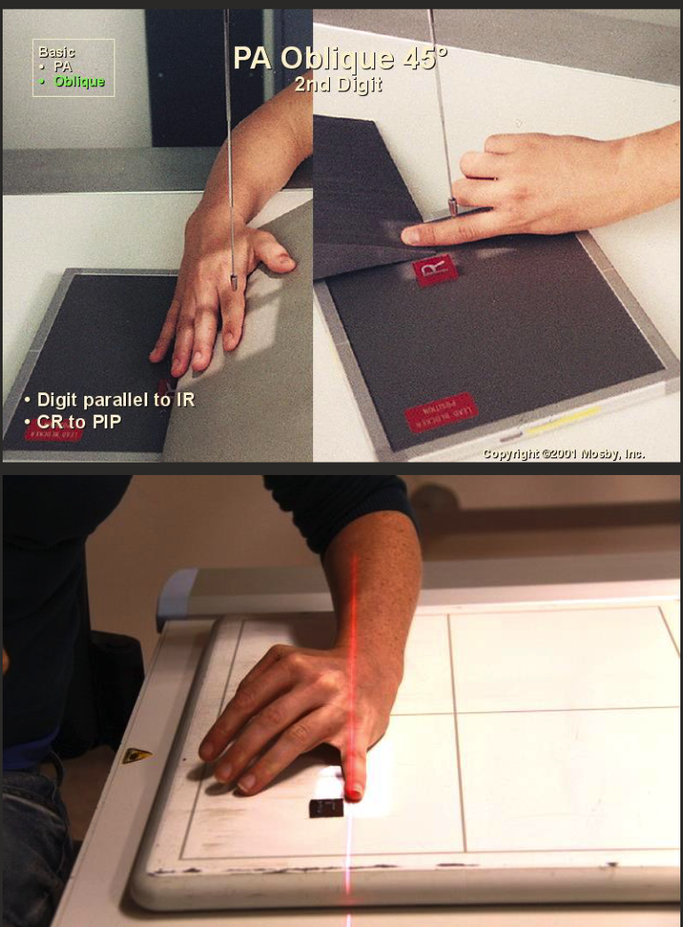 <ul><li><p>Finger of interest aligned parallel to edge of IR.</p></li><li><p>From PA position, rotate (supinate) hand and wrist 45° (radial aspect raised).</p></li><li><p>CR perpendicular to IR, collimate to digit including skin edge and MC in collimation.</p></li><li><p>CR over proximal phalanx.</p></li></ul><p></p>