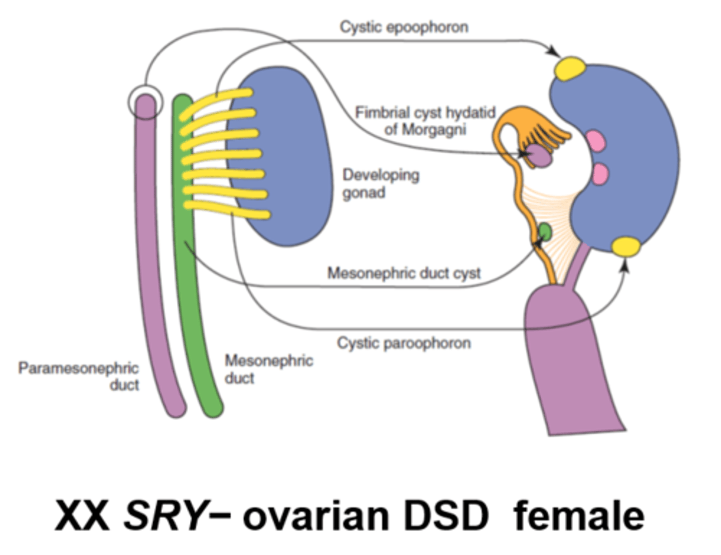 <p>Female mammalians with XX sex chromosomes and abnormal sexual development are myriad (so they have XX chromosomes so are SRY negative but have ovarian DSD due to mutations or abnormalities in ovarian development or hormone regulation).</p>
