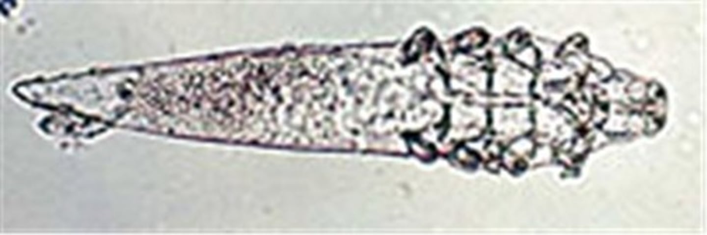 <p>This was found on a dog with a small, well circumscribed hairless area on his front leg. What is it? Is it contagious to humans?</p>