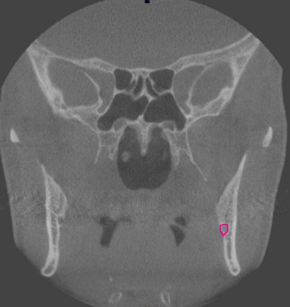 <p>identify structure </p>