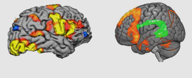 <ul><li><p>it is a rapid series of MRI scans that reveal the movement of oxygenated blood</p></li><li><p>Ex: when a brain area is active, blood flow to that region increases within 5 seconds. We can then identify changes in neural activity by tracking oxygenated blood</p></li><li><p>Doesn’t involve needles, surgery, or radioactivity </p></li><li><p>Decent spatial resolution and temporal resolution </p></li></ul><p></p>