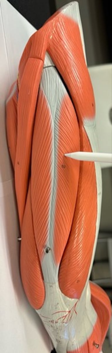 <p>What are the (4) attachments of the Rectus Femoris?</p>