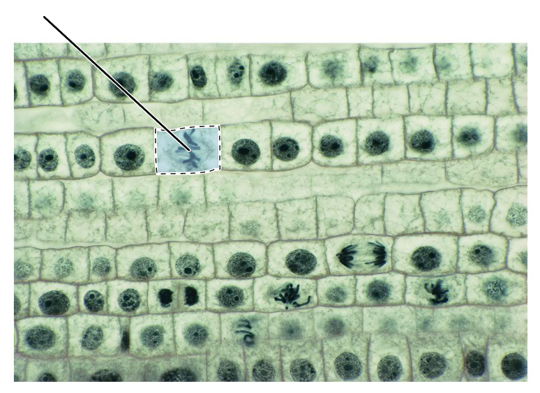 <p>What stage of mitosis is shown by the highlighted cell?</p><p>(Longitudinal section of an onion root tip).</p>
