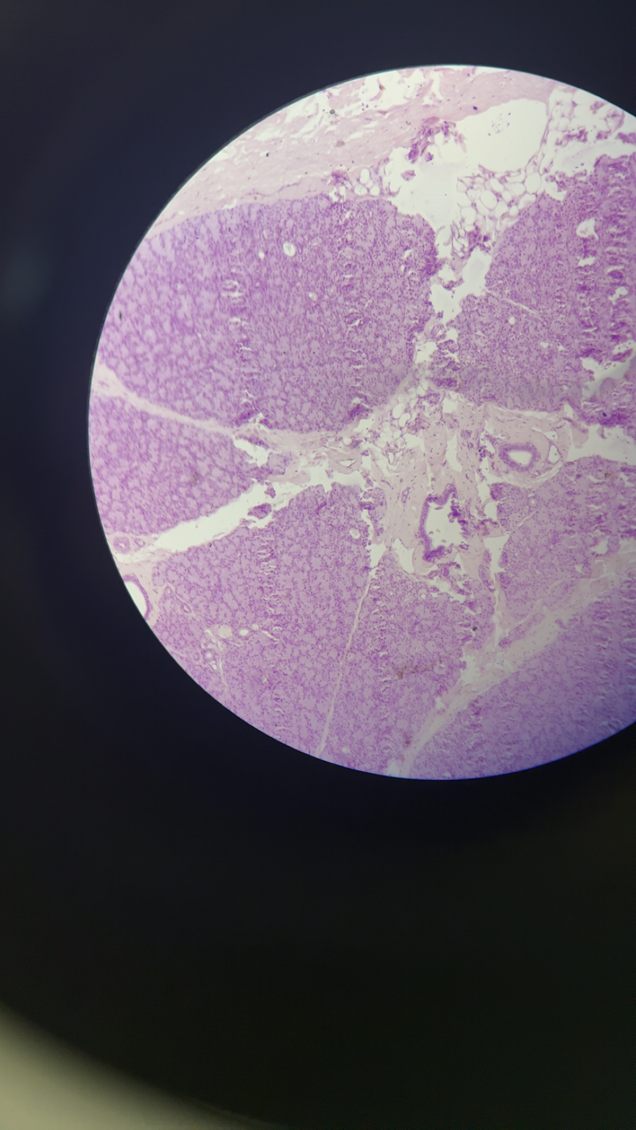 <p>either pair of large salivary glands situated just in front of each ear</p>