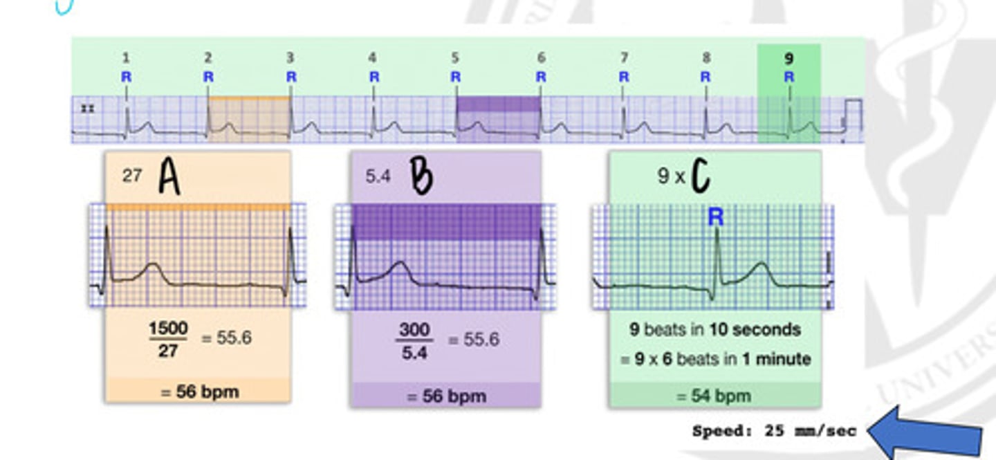 <p>In what way can you get a heart rate, represented by "A"?</p>