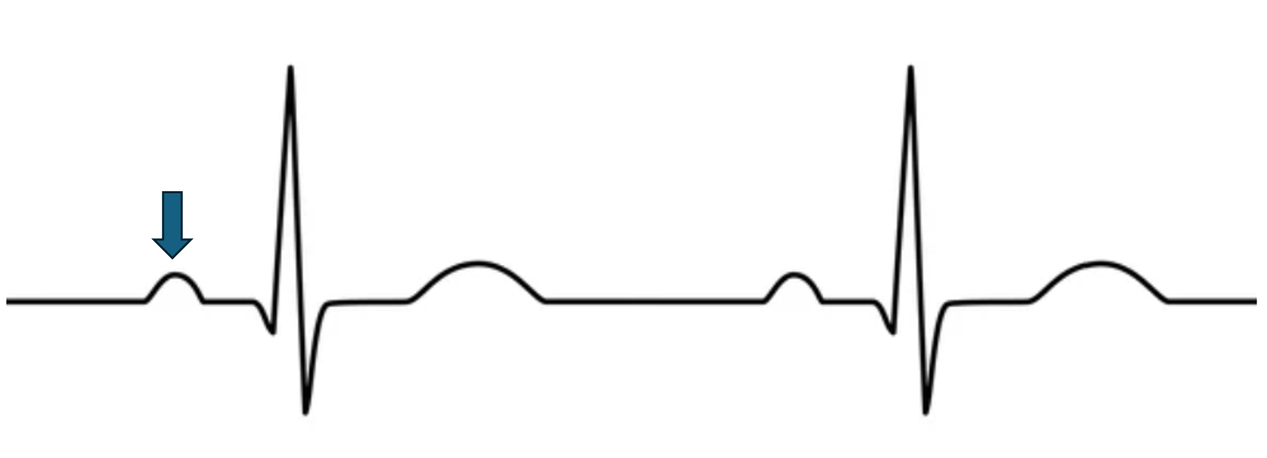 <p>what does this represent?</p>