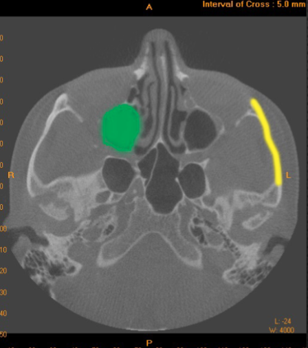 <p>what is indicated by the <mark data-color="#f9e11d" style="background-color: #f9e11d; color: inherit">YELLOW</mark></p>