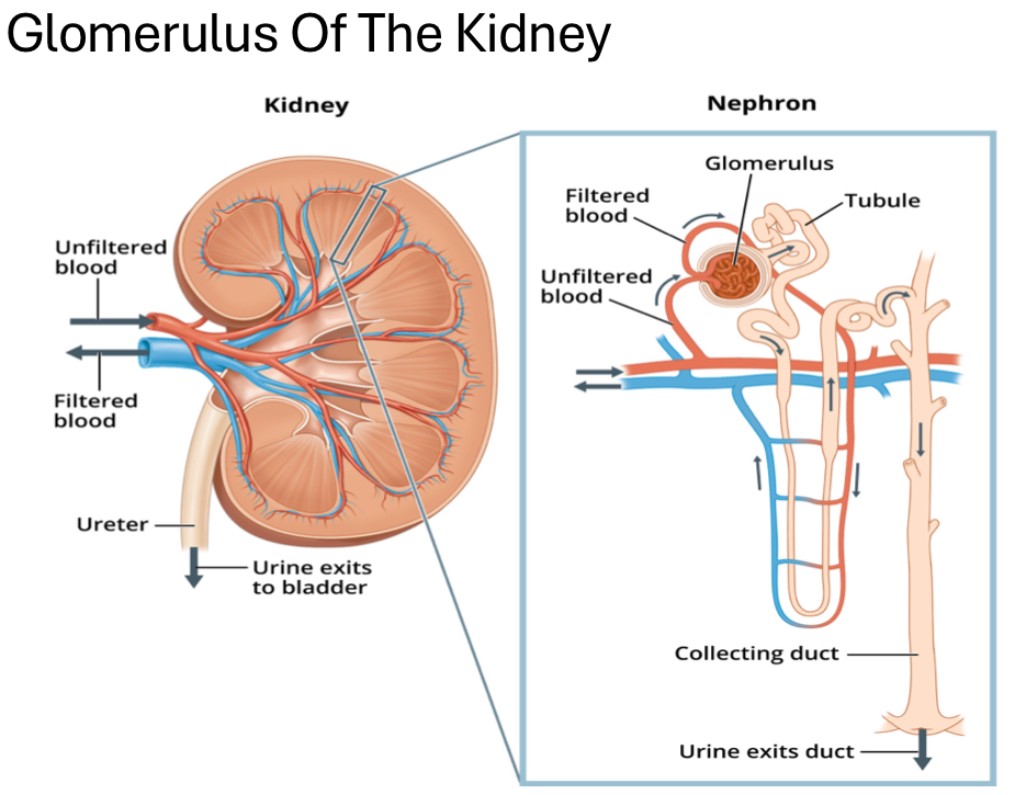 <p>increase in <strong>proteinuria</strong> (albumin), <strong>blood urea nitrogen</strong> (BUN), <strong>serum creatine</strong> (waste build up in blood due to muscle activity) and <strong>decrease in GFR</strong></p><ul><li><p>kidney damage → increase in BP → hyperperfusion in retina</p></li></ul><p>*proteinuria = protein in urine</p><p></p>