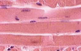 <p>What type of muscle is this?</p>