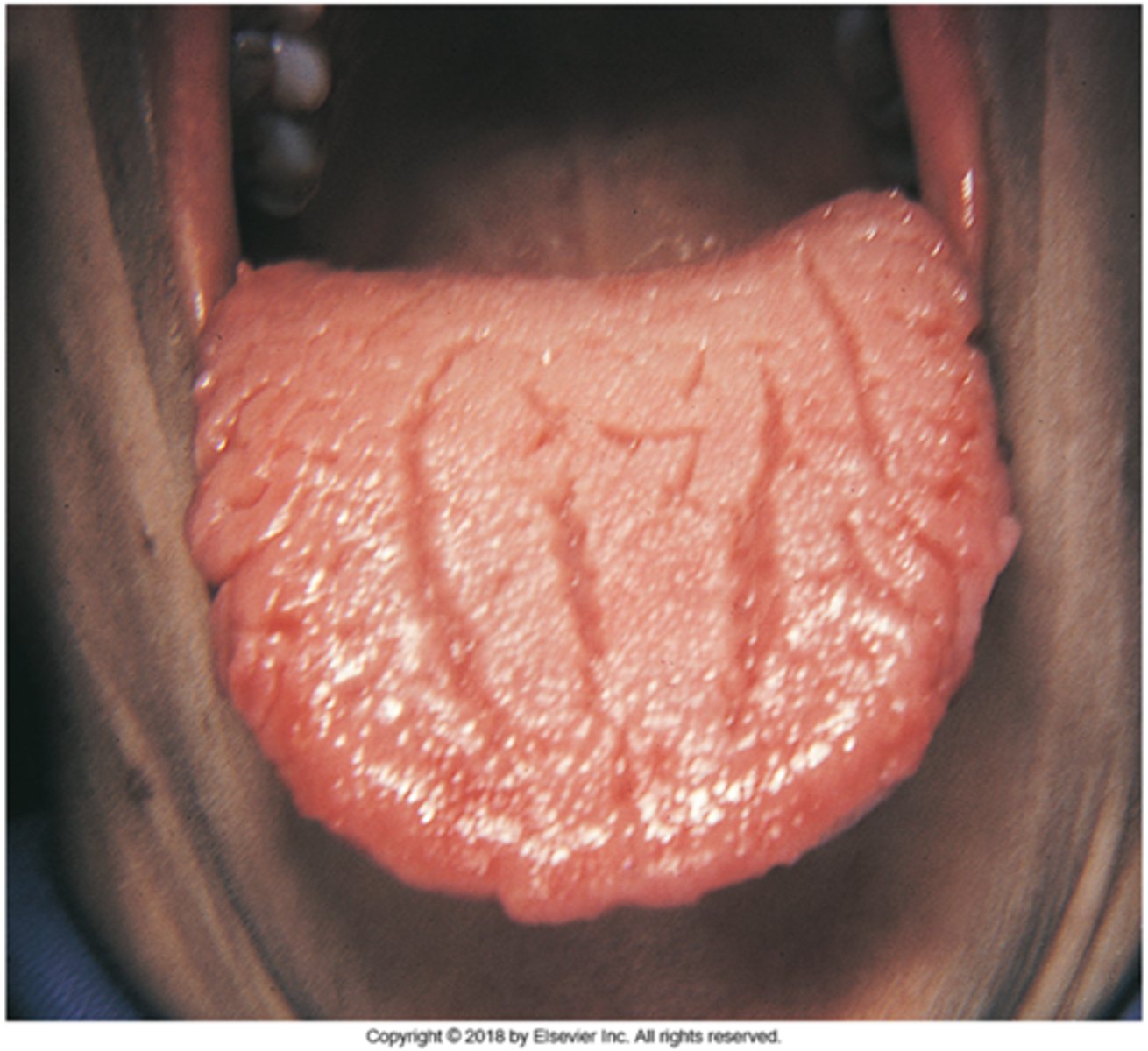 knowt flashcard image