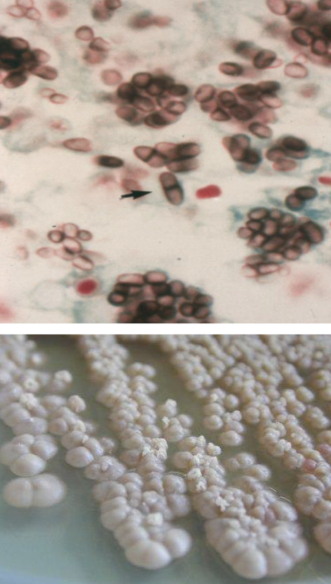 <p>Talaromyces marneffei yeast phase</p>
