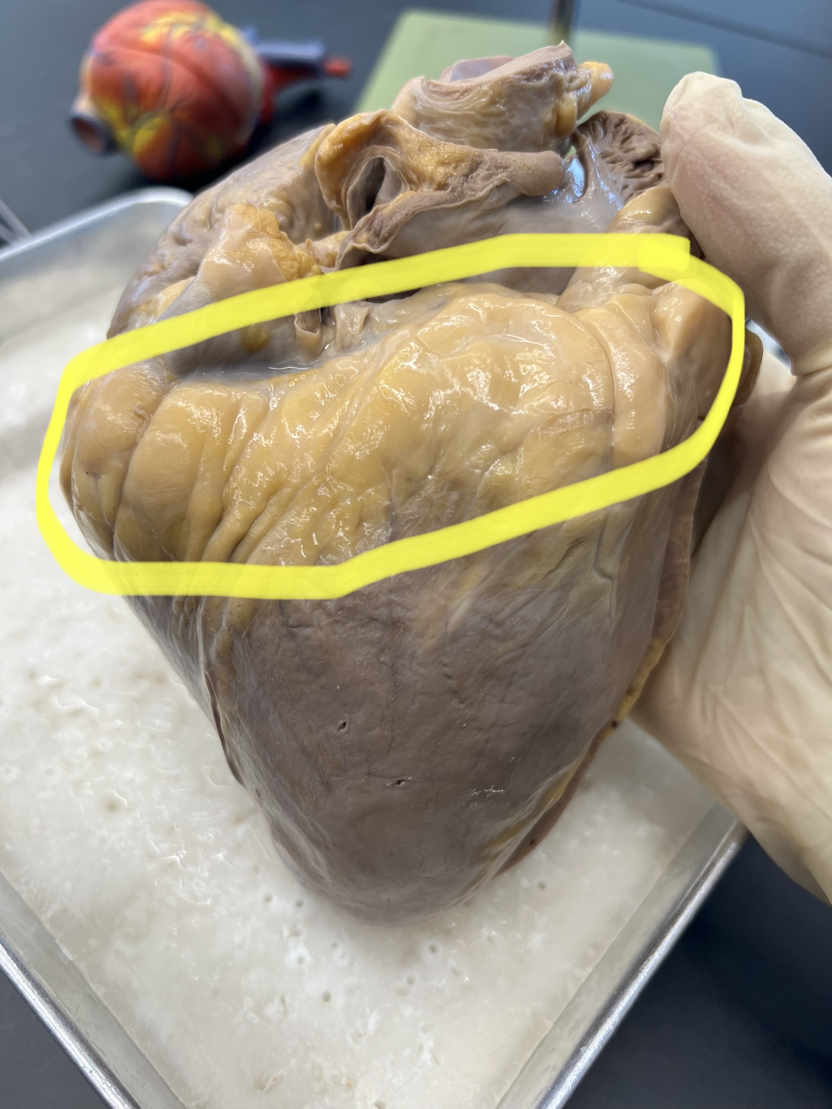 Name the heart structure.