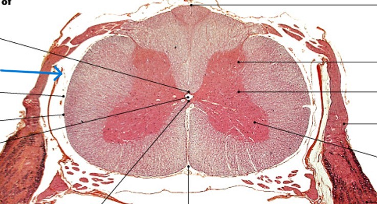 <p>Which meningeal layer is:</p><ul><li><p>Outer layer of spinal cord</p></li><li><p>Tough and fibrous</p></li></ul><p></p>