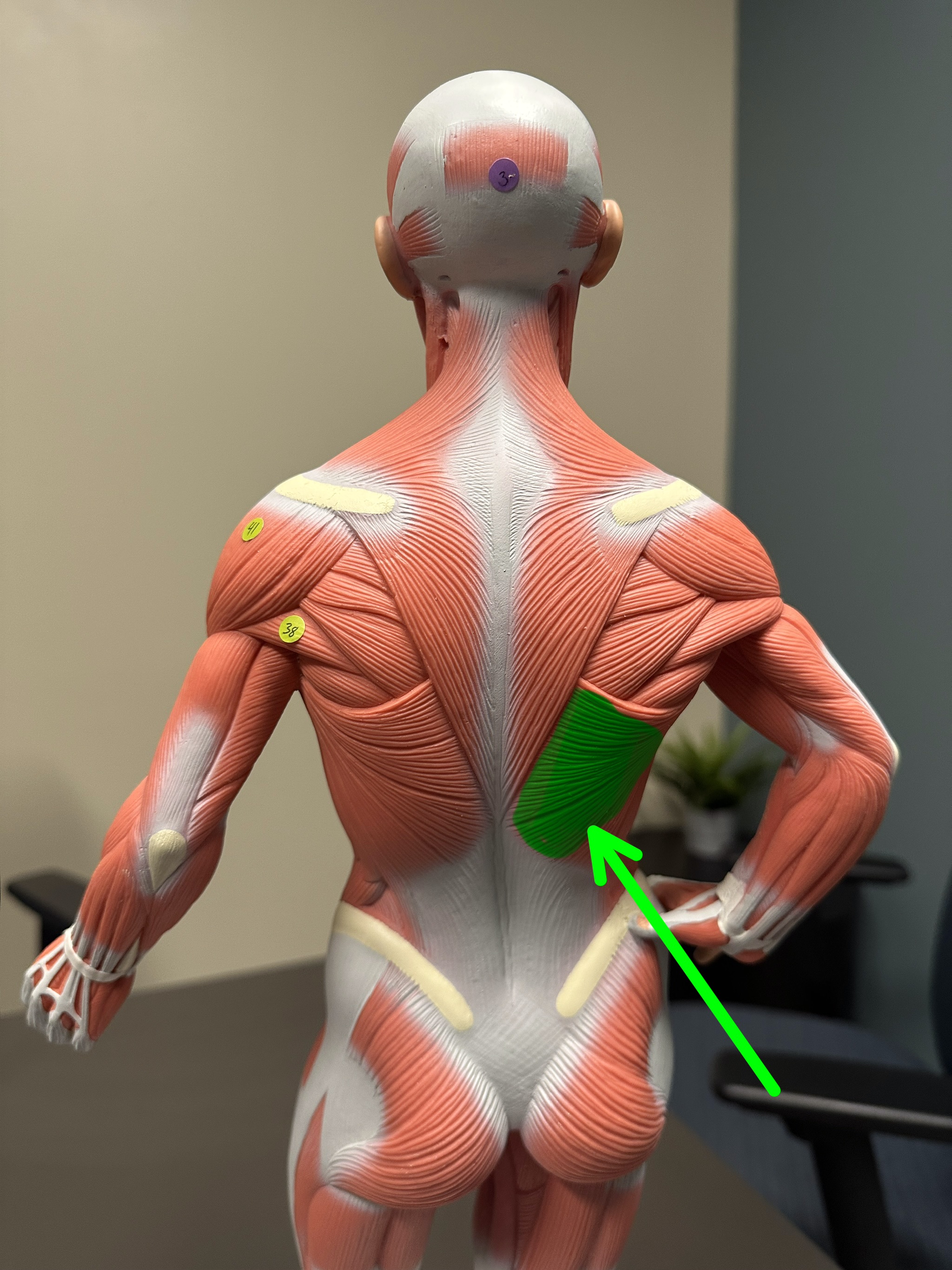 <p>What is the highlighted structure</p>