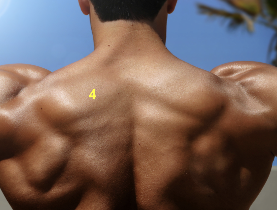 <p>What are the characteristics of a trapezius regarding appearance and location? </p>