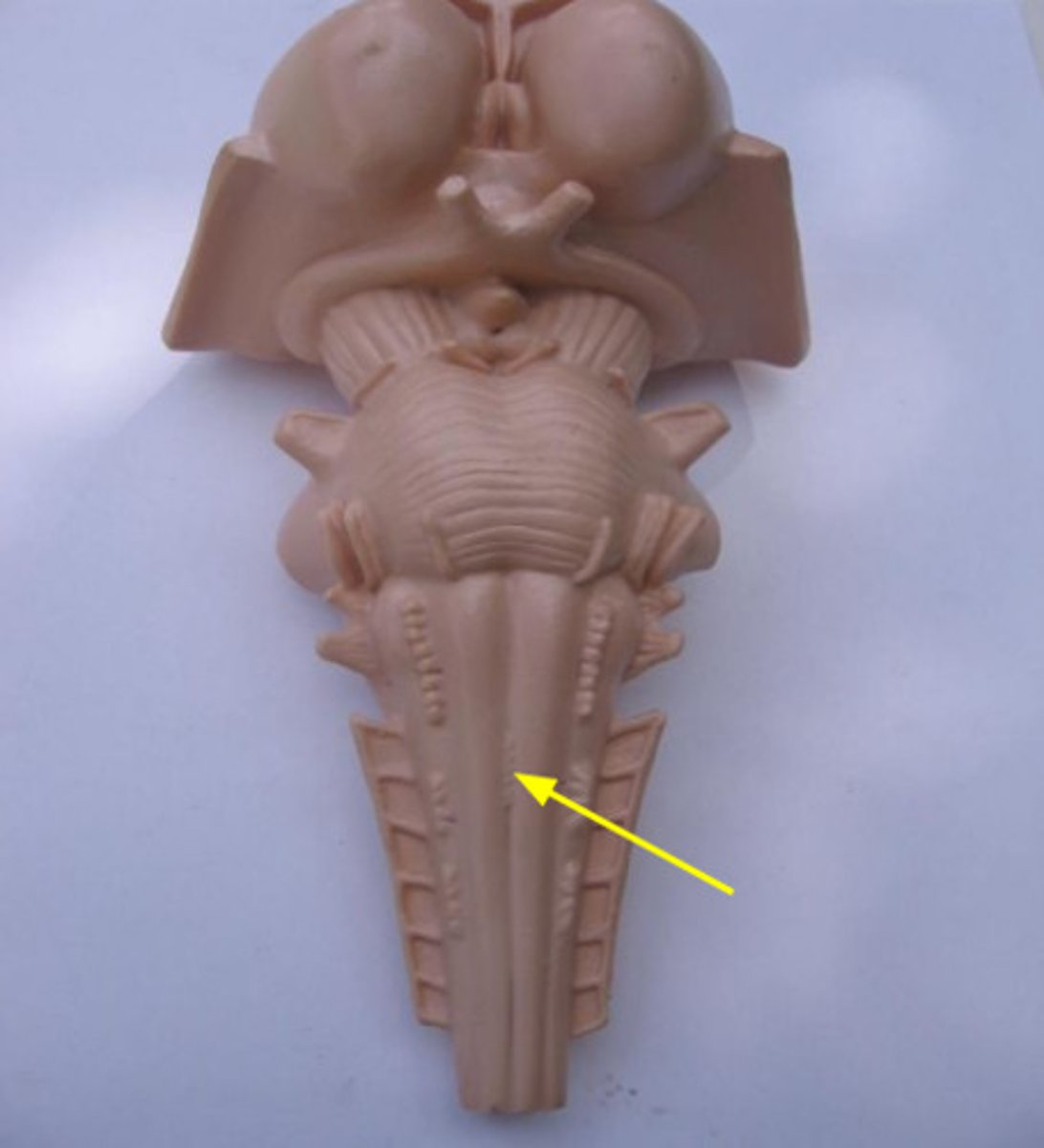 <p>where the cleavage furrow becomes almost flat - the reason for contralateral control</p>