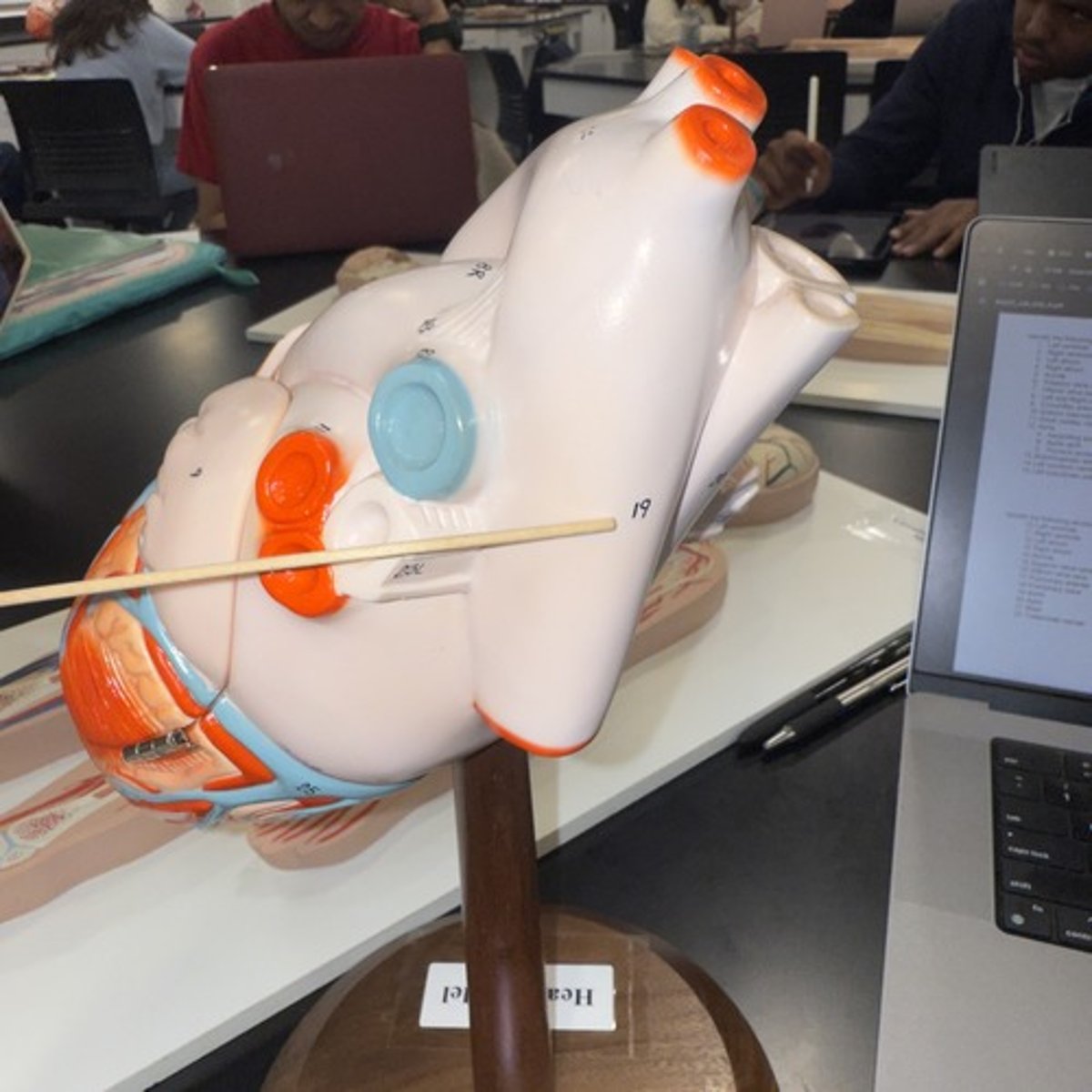 <p>Identify the structure.</p>